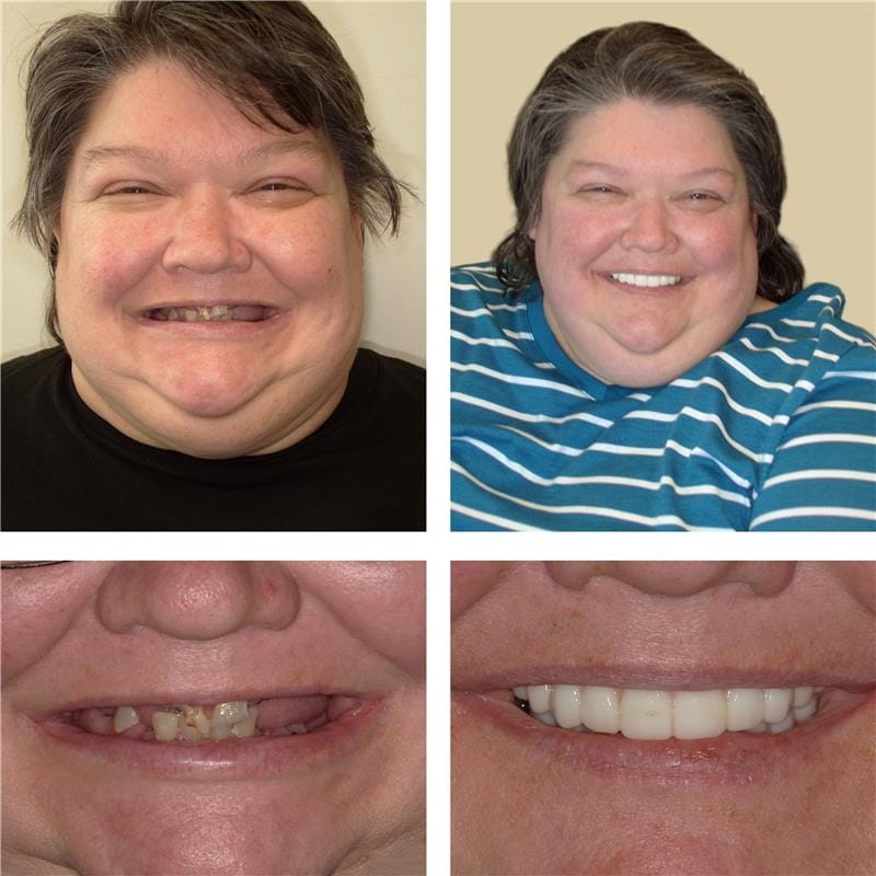 Karin Nieves Before After Image