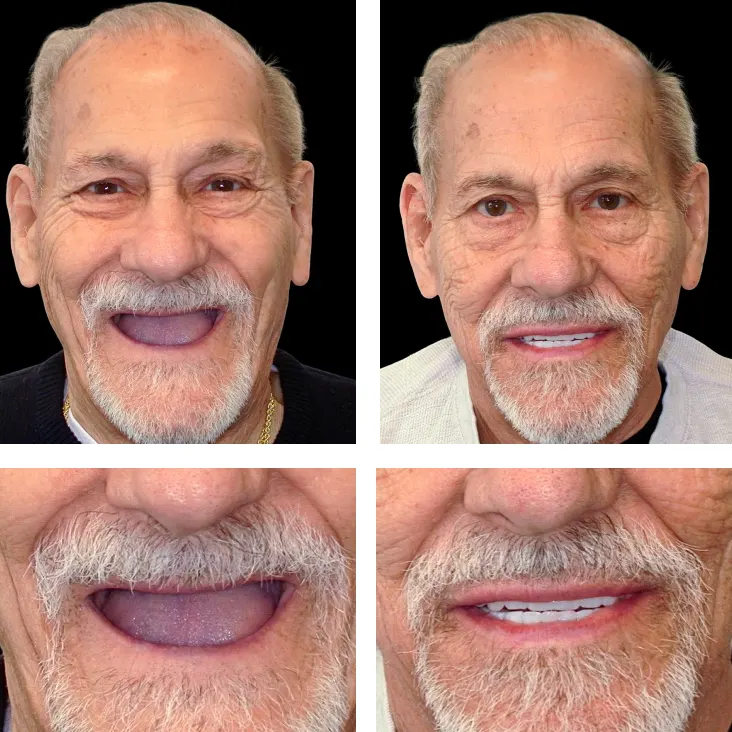 Patient Before After