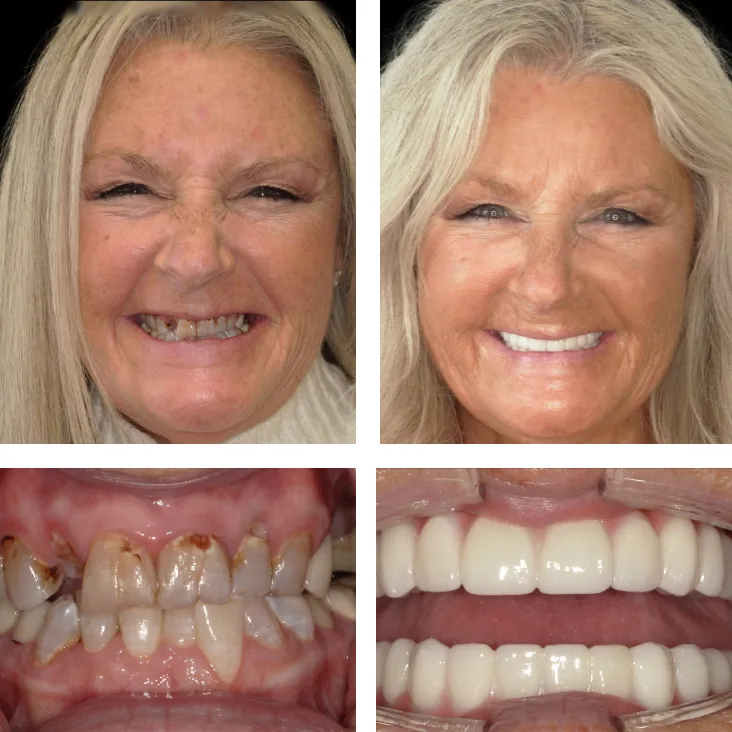 Patient Before After