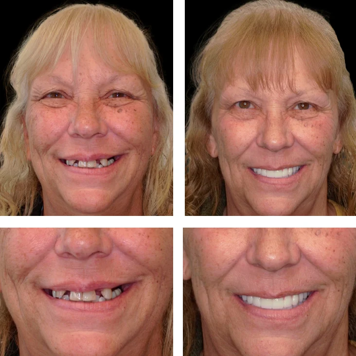 Patient Before After