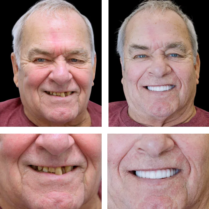 Patient Before After