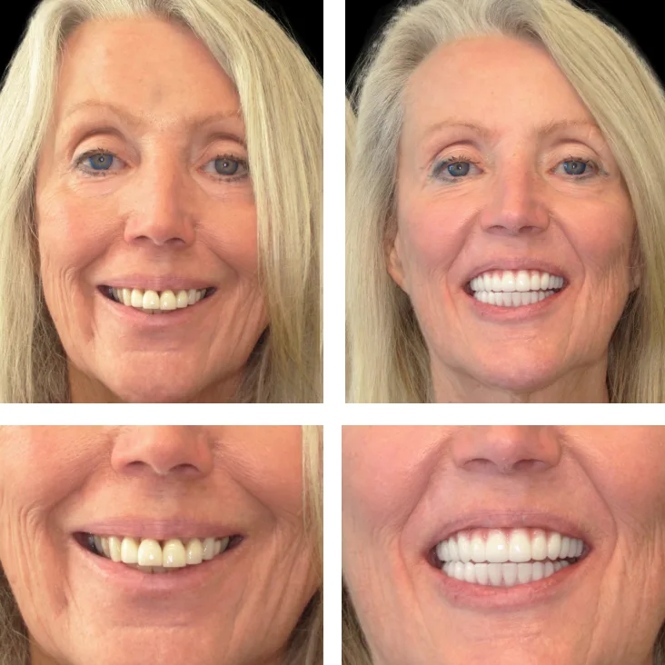 Patient Before After