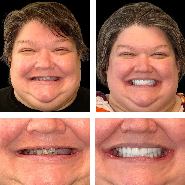 Patient Before After