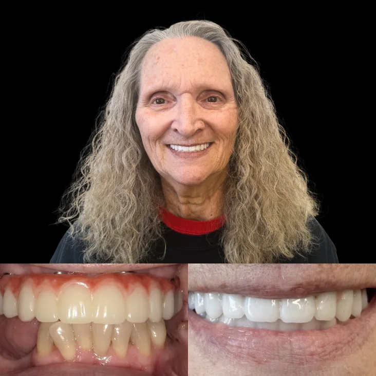 Patient Before After
